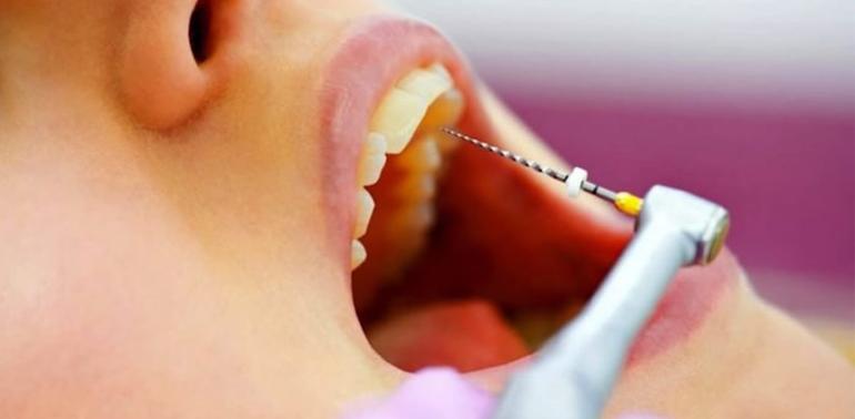 dental care