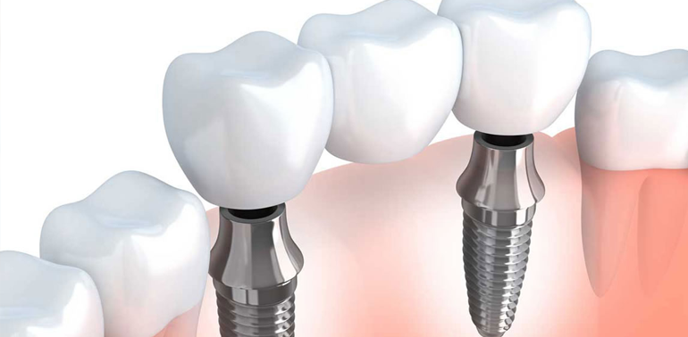 dental care