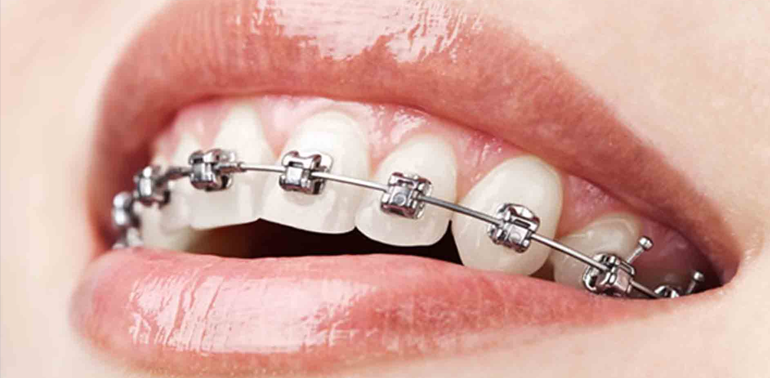 dental care