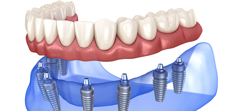 dental care